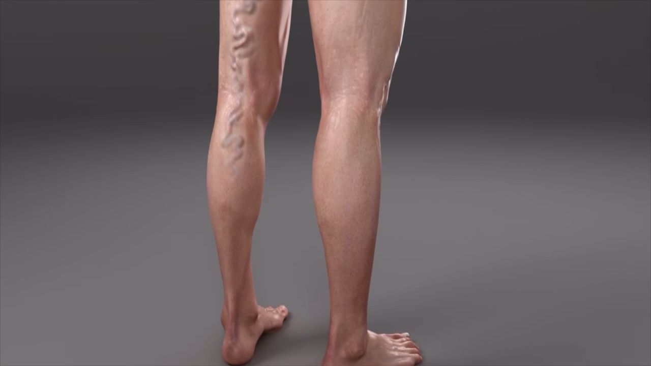 Image default